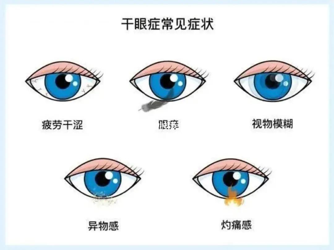 看东西模糊是弱视嘛,看东西模糊是近视