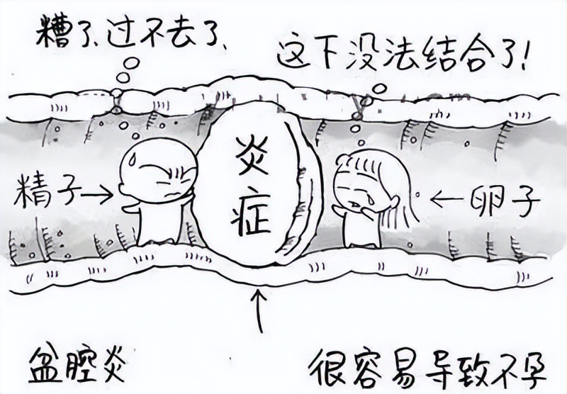 盆腔炎杀手,女性妇科疾病隐形杀手