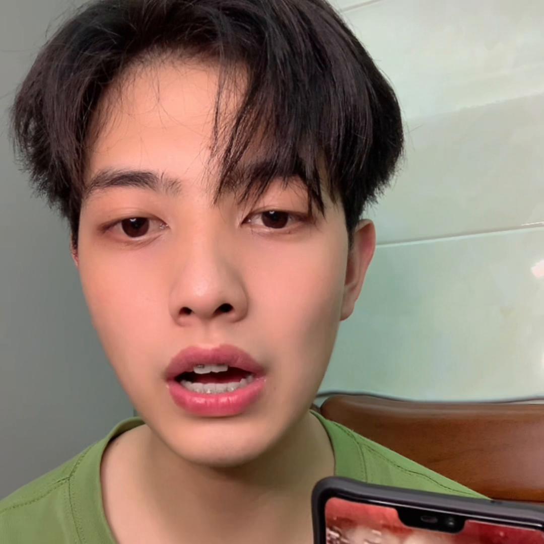 牙套怎么固定在牙上的,牙套矫正过程