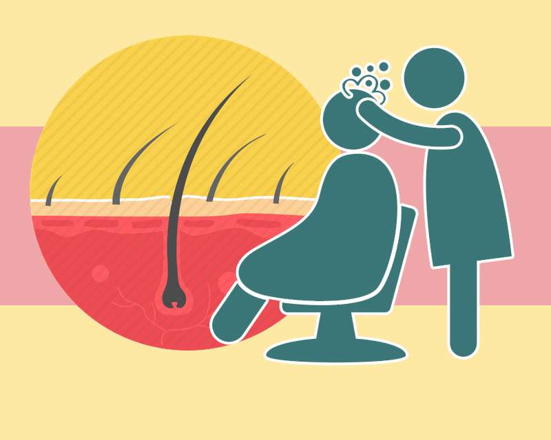 干性头皮天天洗头还是有头皮屑,头皮突然长头皮屑用什么洗发露