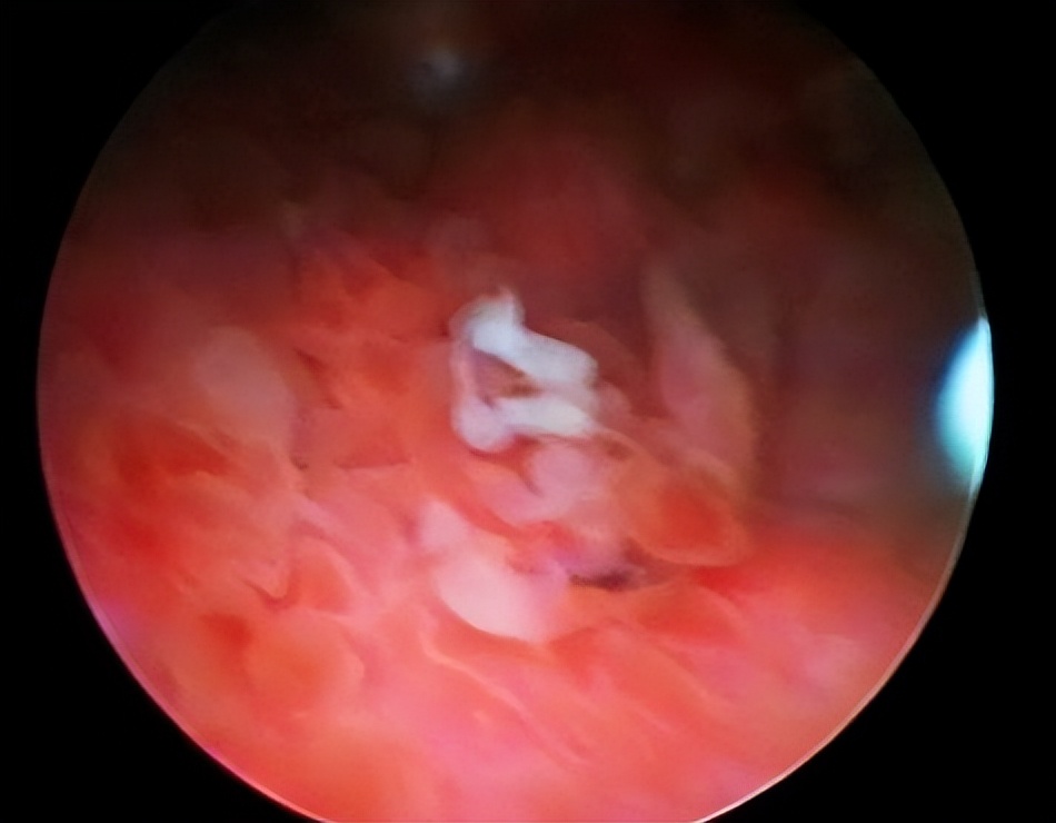 央视新闻衣服致癌物超标,衣服致癌物超标有哪些