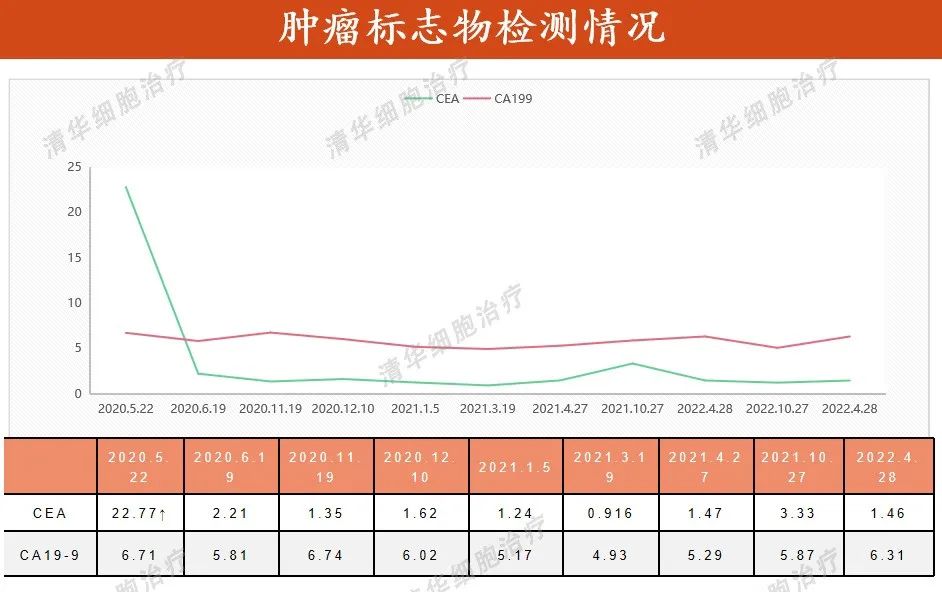 结肠癌术后化疗方案的制定策略,结肠癌手术后热灌注化疗能根治吗