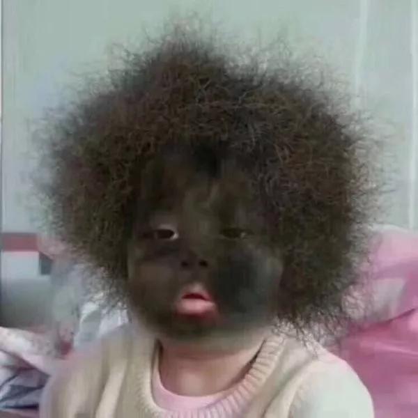 高血压吃盐多的危害,盐吃多了身体有什么危害