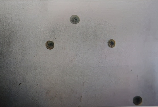 uu感染会自愈么,uu感染是hiv吗