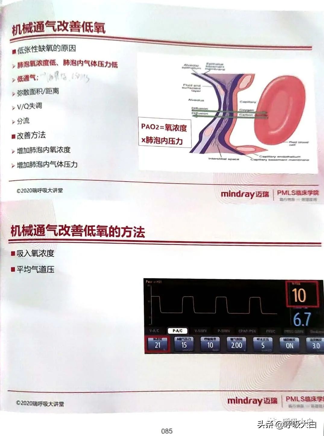 呼吸机epr怎么调节,呼吸机如何调节温度