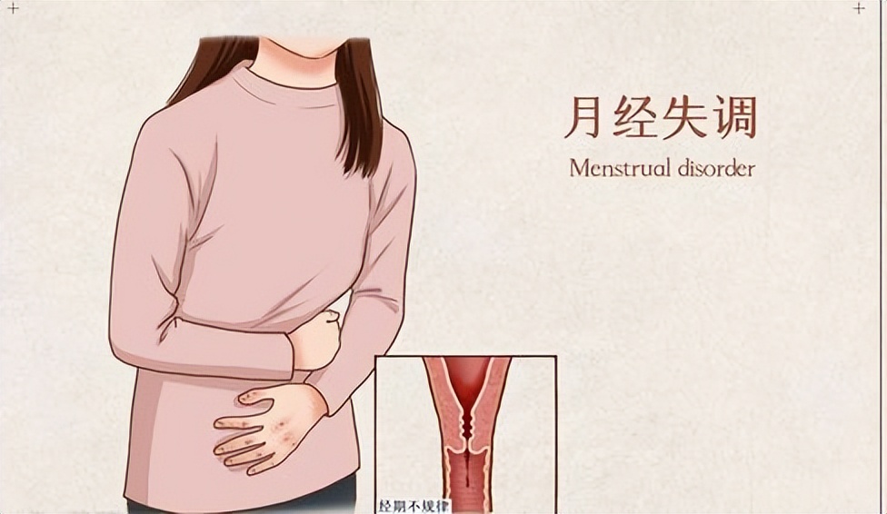 绝经之前的8个征兆怎么调理,绝经前的十大症状及表现