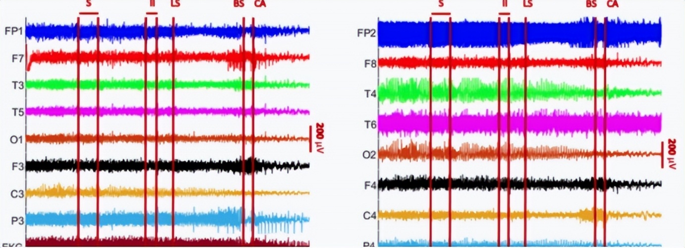 人死亡前会想什么,人去世时会想什么