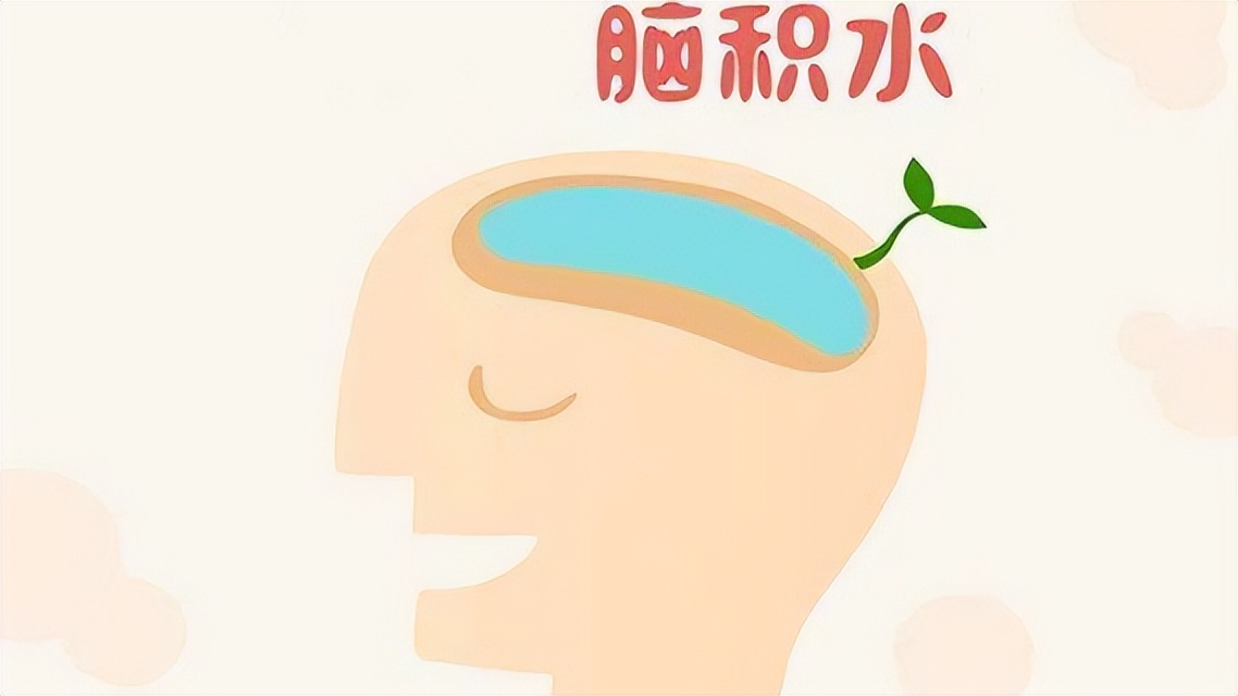 先天性脑积水能坚持多久,成人先天脑积水有必要治疗吗