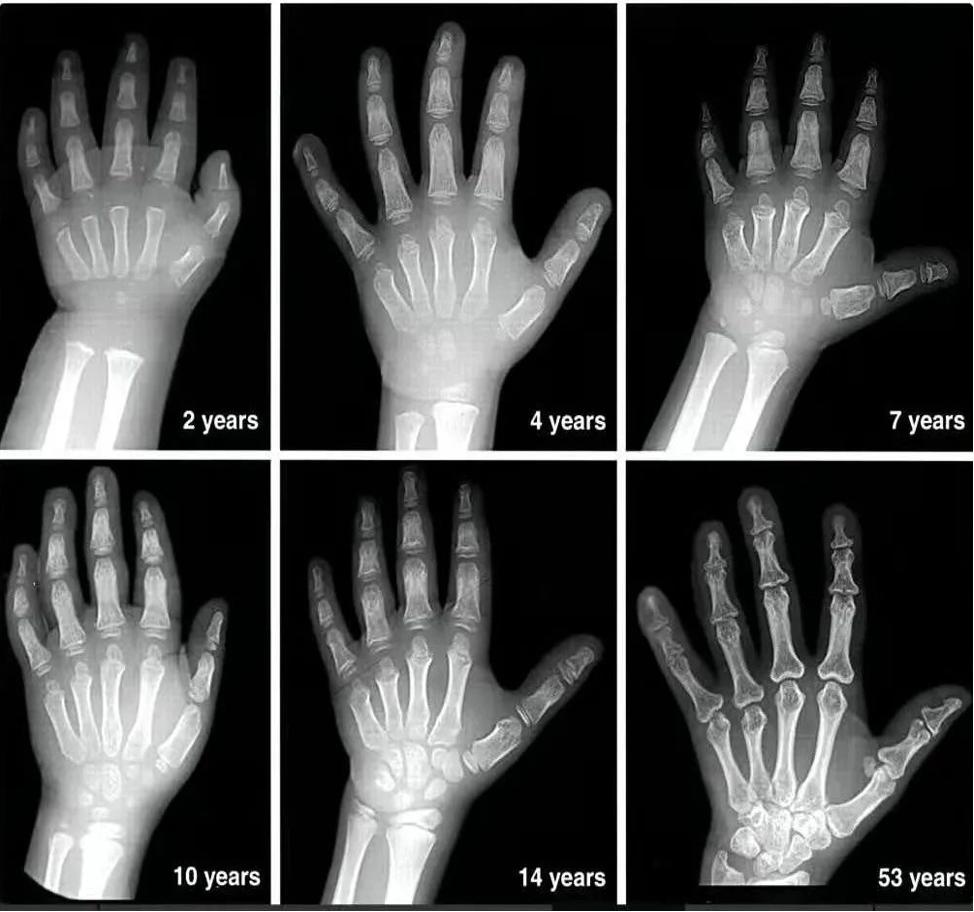 孩子身高标准表2023最新图文,孩子身高标准表2023最新从哪里查