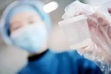 精子检查有什么注意事项,精子检查主要事项