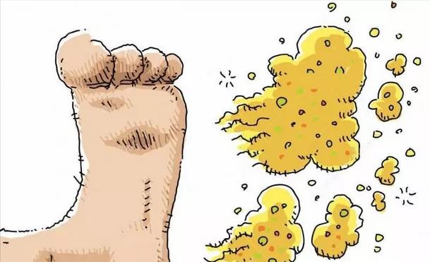 脚气好痒怎么办,脚气太痒怎么办教你一招