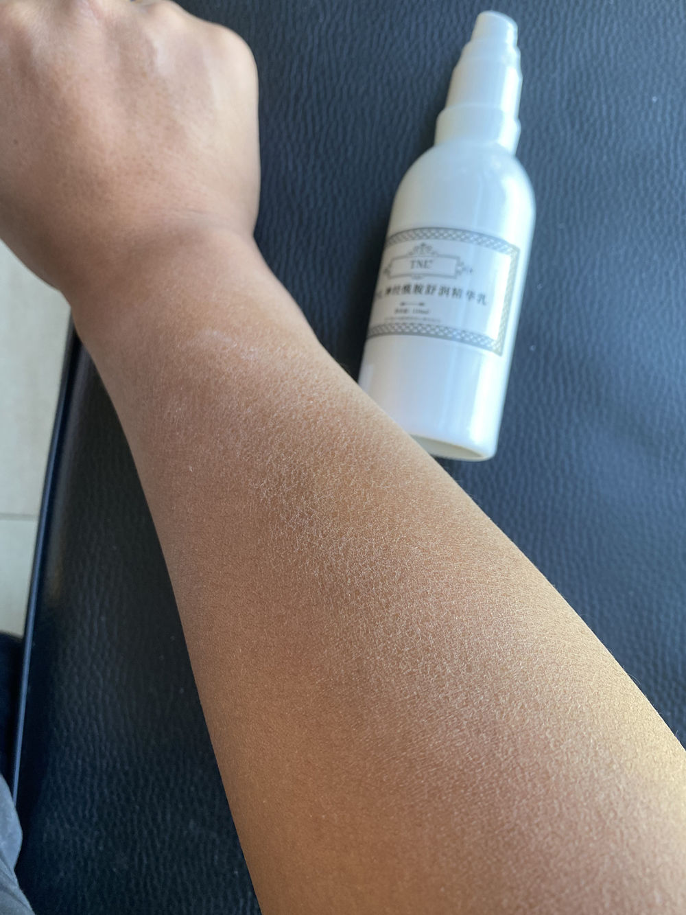 每到秋天，手和腿上就会出现各种干燥情况，还会脱皮，要怎么办？