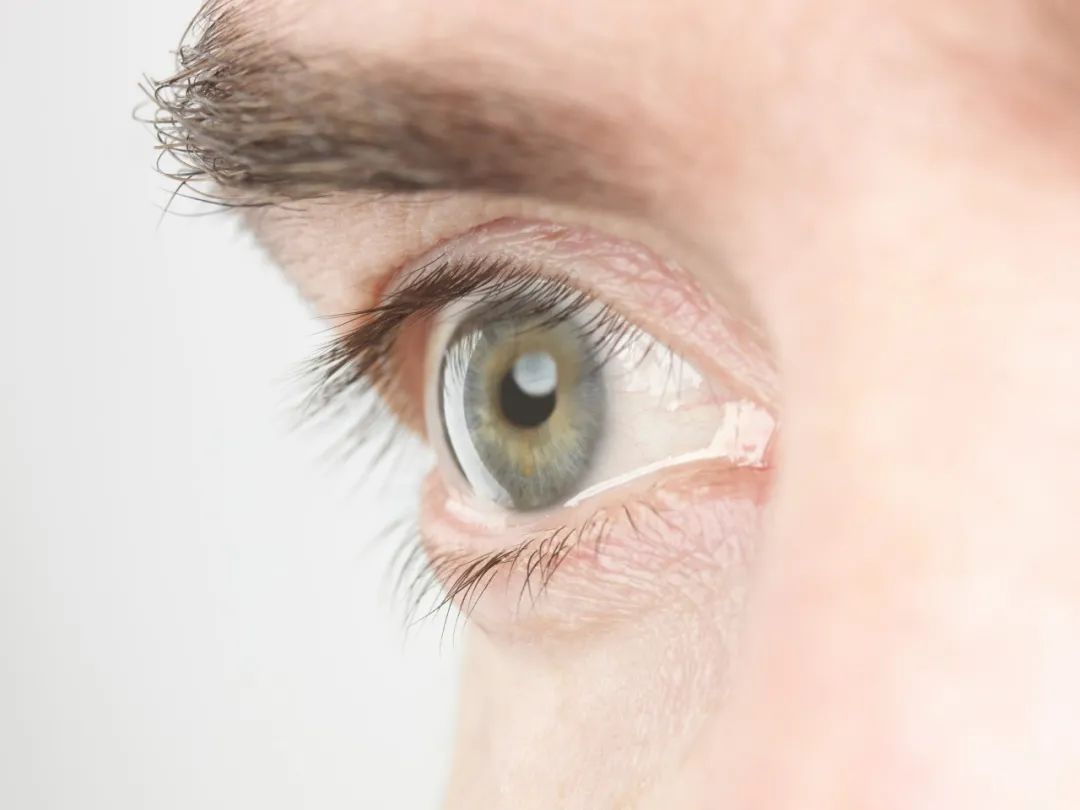 眼压高怎么舒缓,舒缓眼压的方法