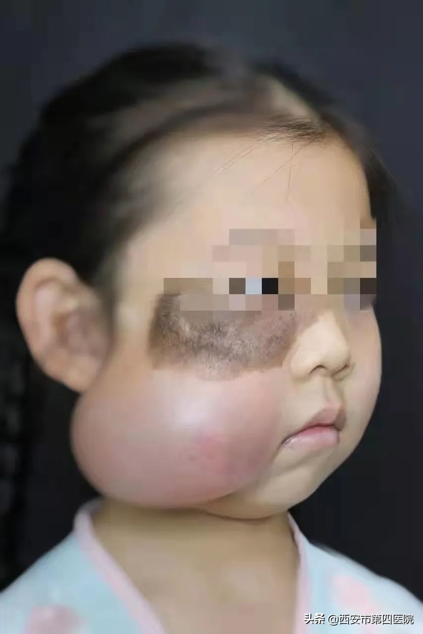 中国健康行动20192023,中国儿童健康行动视频