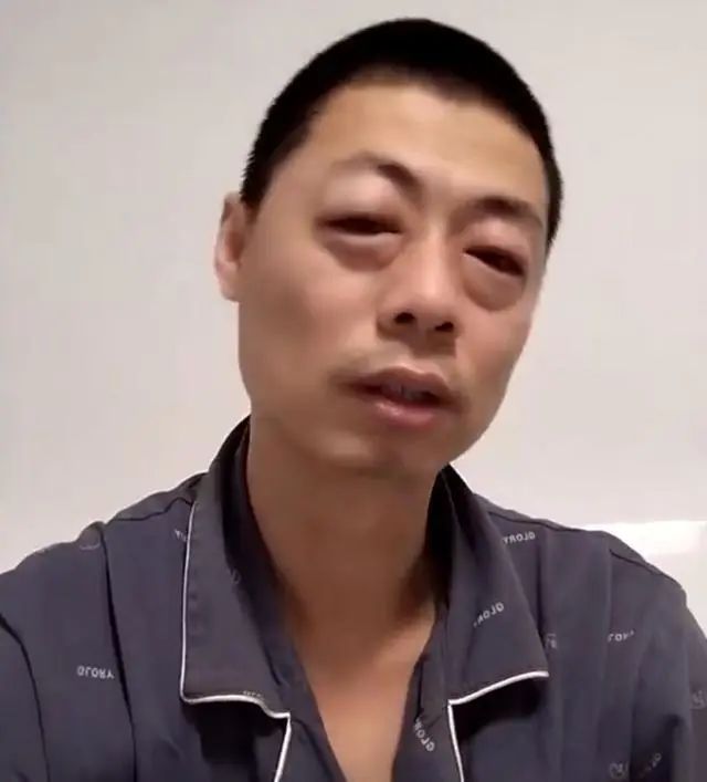 阳了会一夜白头？牙齿舌头全变黑？胃口变大好几倍？网友症状千奇百怪！还有人想主动感染“温和株”？