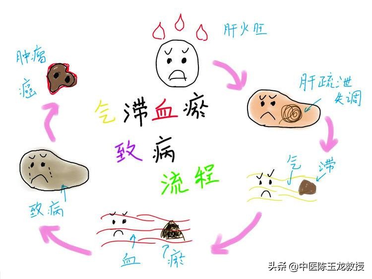 中医治疗膀胱结石经典处方,治疗胆结石肾结石膀胱结石的方子