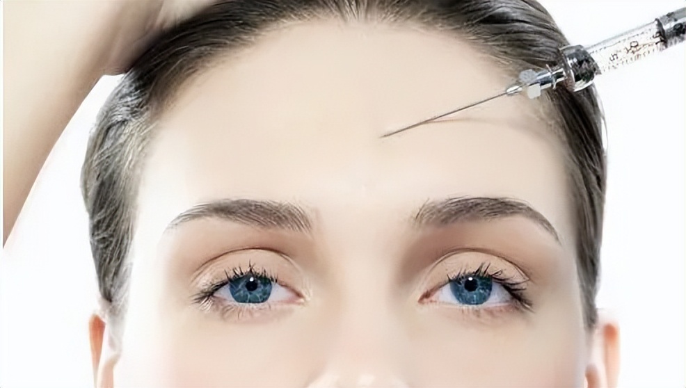 玻尿酸打额头的方法,玻尿酸打鼻子山根变宽真实案例