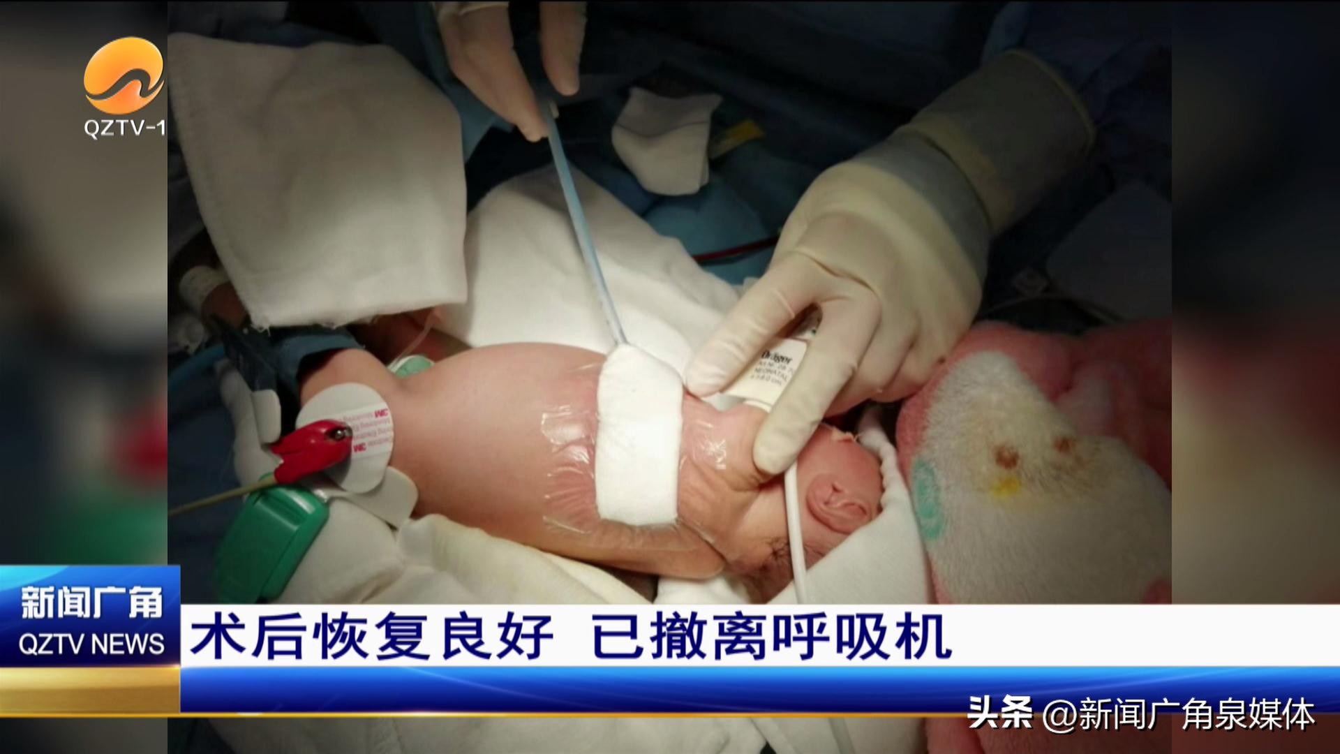 福建省儿童医院心脏介入,泉州儿童医院心外科