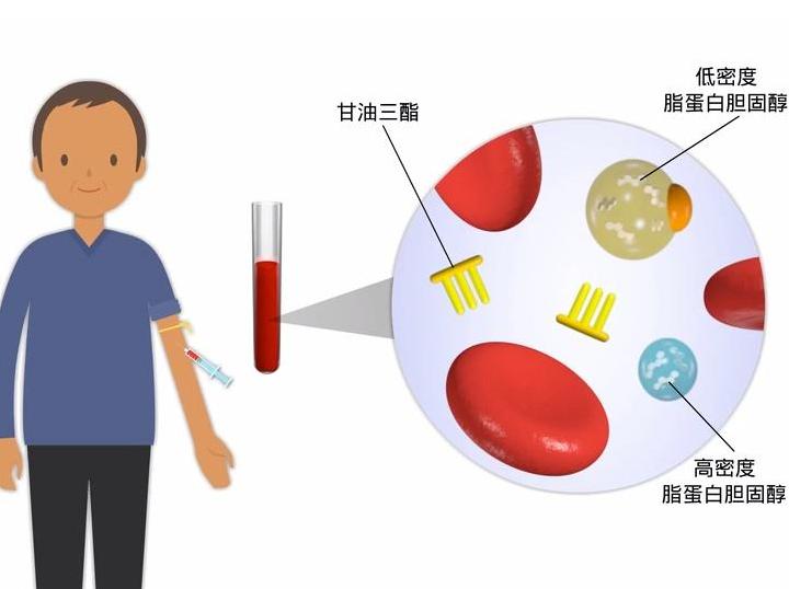 儿童骨密度检测中bmi正常范围,34岁骨密度检测说骨质疏松怎么办
