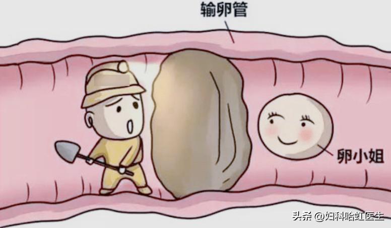 输卵管积液堵塞可以治愈好吗,左侧输卵管伞端堵塞能治愈吗