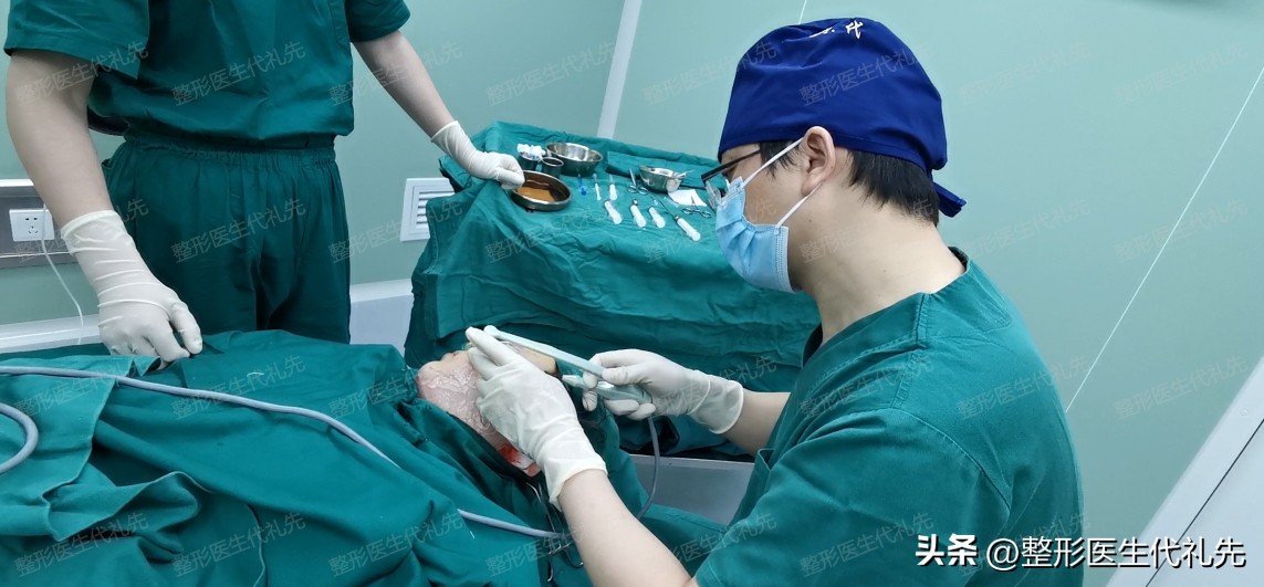 口角囊袋修复效果,口角囊袋成功修复案例