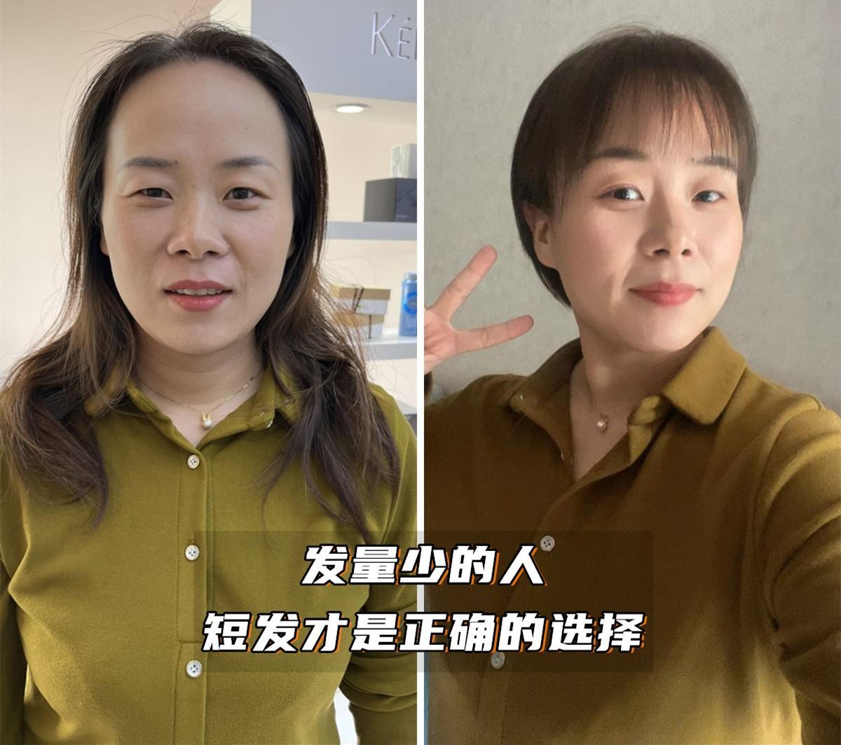 年纪大了为什么头发稀疏了,随着年龄增长头发变稀疏正常吗