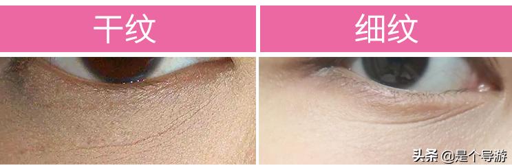 眼角有细纹干纹可以擦维生素e吗,眼睛下的细纹是怎么造成的
