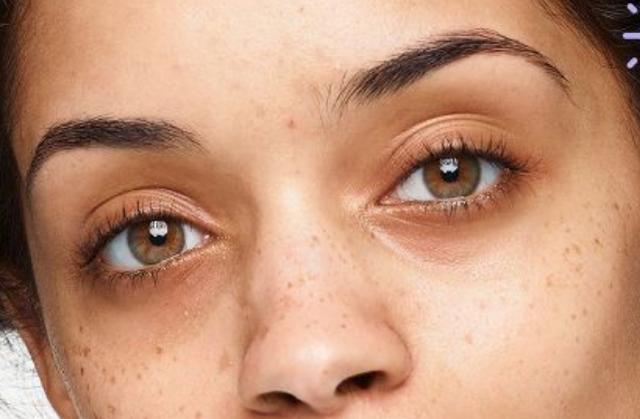 皮肤暗沉发黄如何提亮肤色医美,皮肤暗沉无光泽怎么免费调理