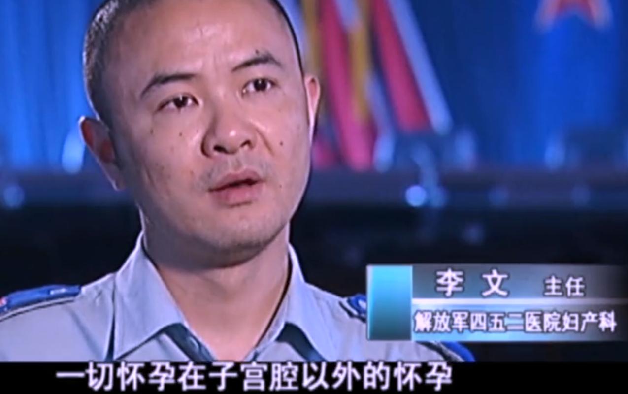 2007年四川90岁老妇，腹中怀子60年未生，后检查发现胎儿没有腐烂