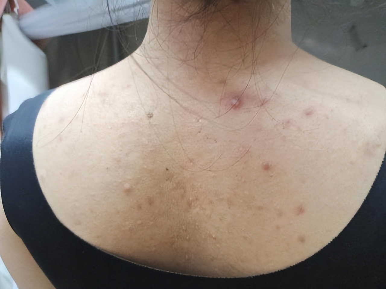 多喝一茶7天排出湿气,女性湿气重喝什么茶可以减肥