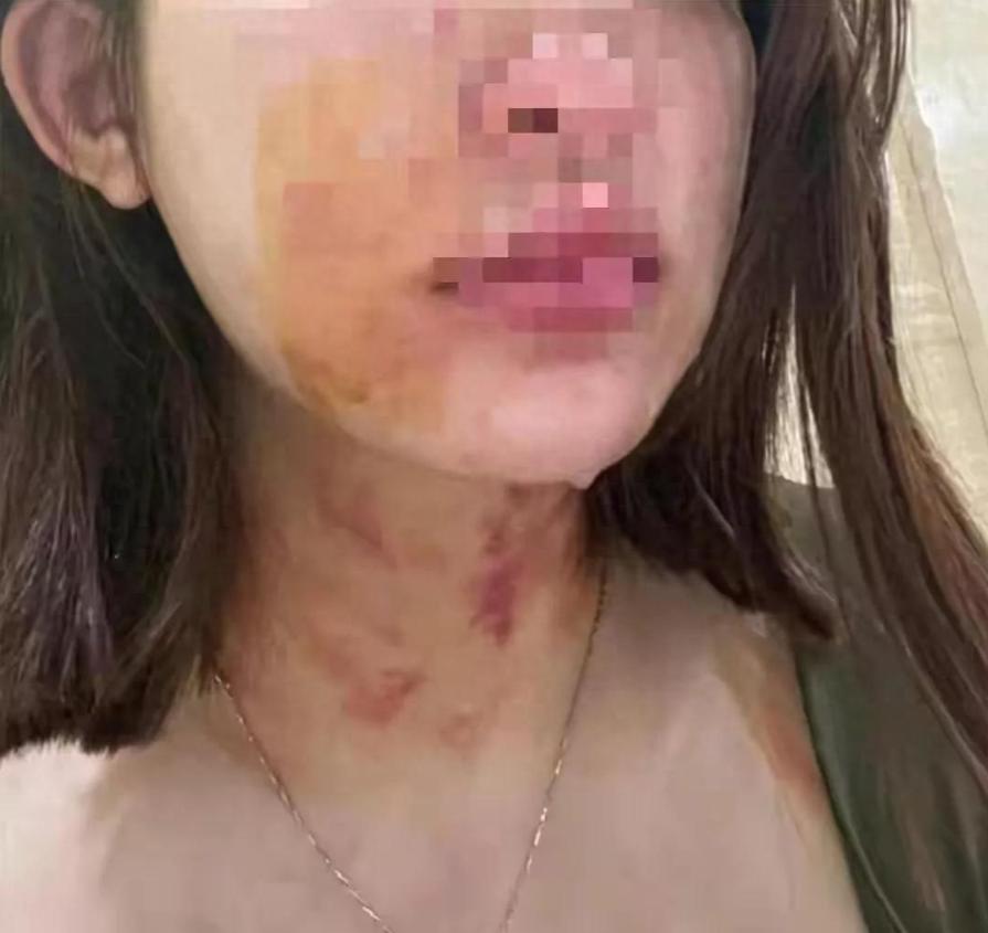 闹大了！电梯内狗尾巴扫腿，23岁女子在打斗中被扯下衣服！真惨烈