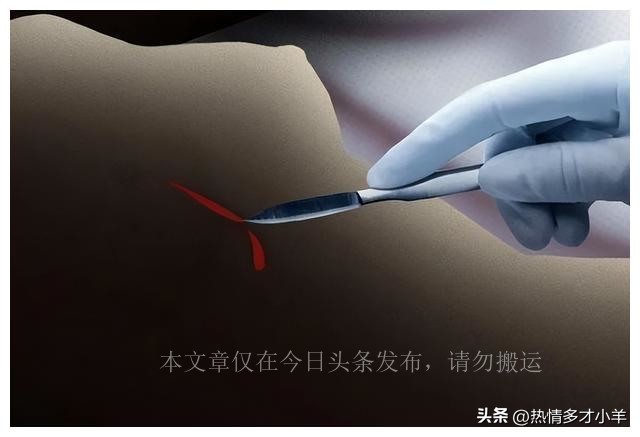 人类“隆胸”发展史:第一批“隆胸”的女人,后来都怎么样了?