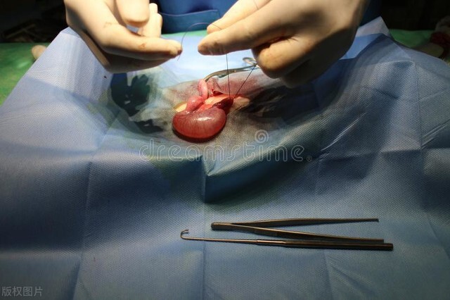 女人附件处有肿块怎么回事,私密旁边有肿块是什么原因