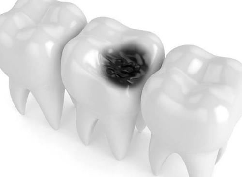 牙痛值得收藏的处方药,牙痛十个妙方建议收藏