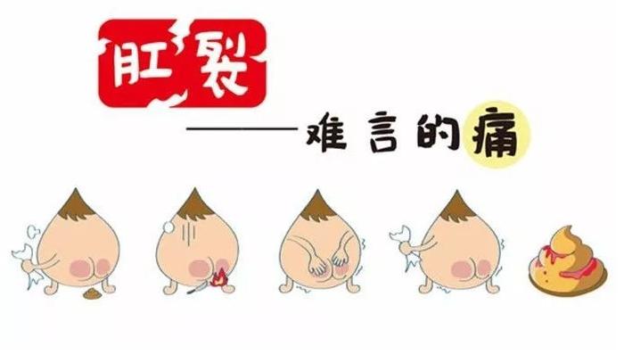 你洗屁屁吗？肛门也需要保护，医生：经常清洗肛门，预防这3种病