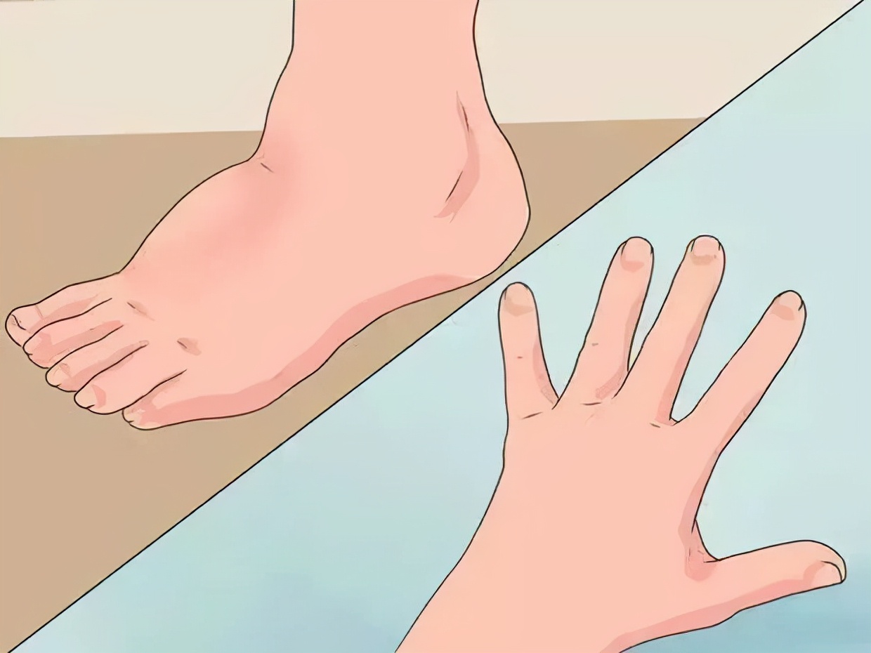 孕期各种不适怎么处理,孕期常见身体不适的缓解方法课件