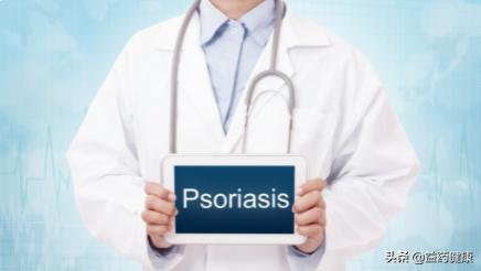 他卡西醇软膏能治牛皮癣吗,他卡西醇软膏能用于头皮银屑病么