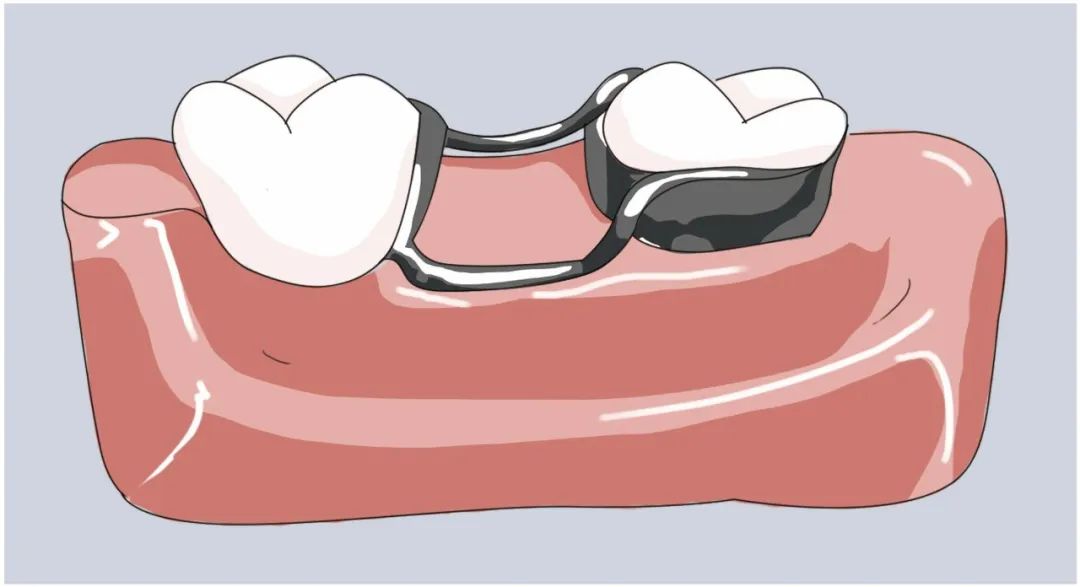广州正畸医生许跃收费,正畸教授许跃案例