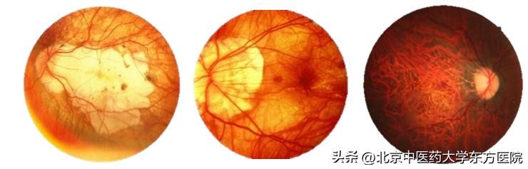 全国爱眼日治疗近视有优惠吗,世界爱眼日主题