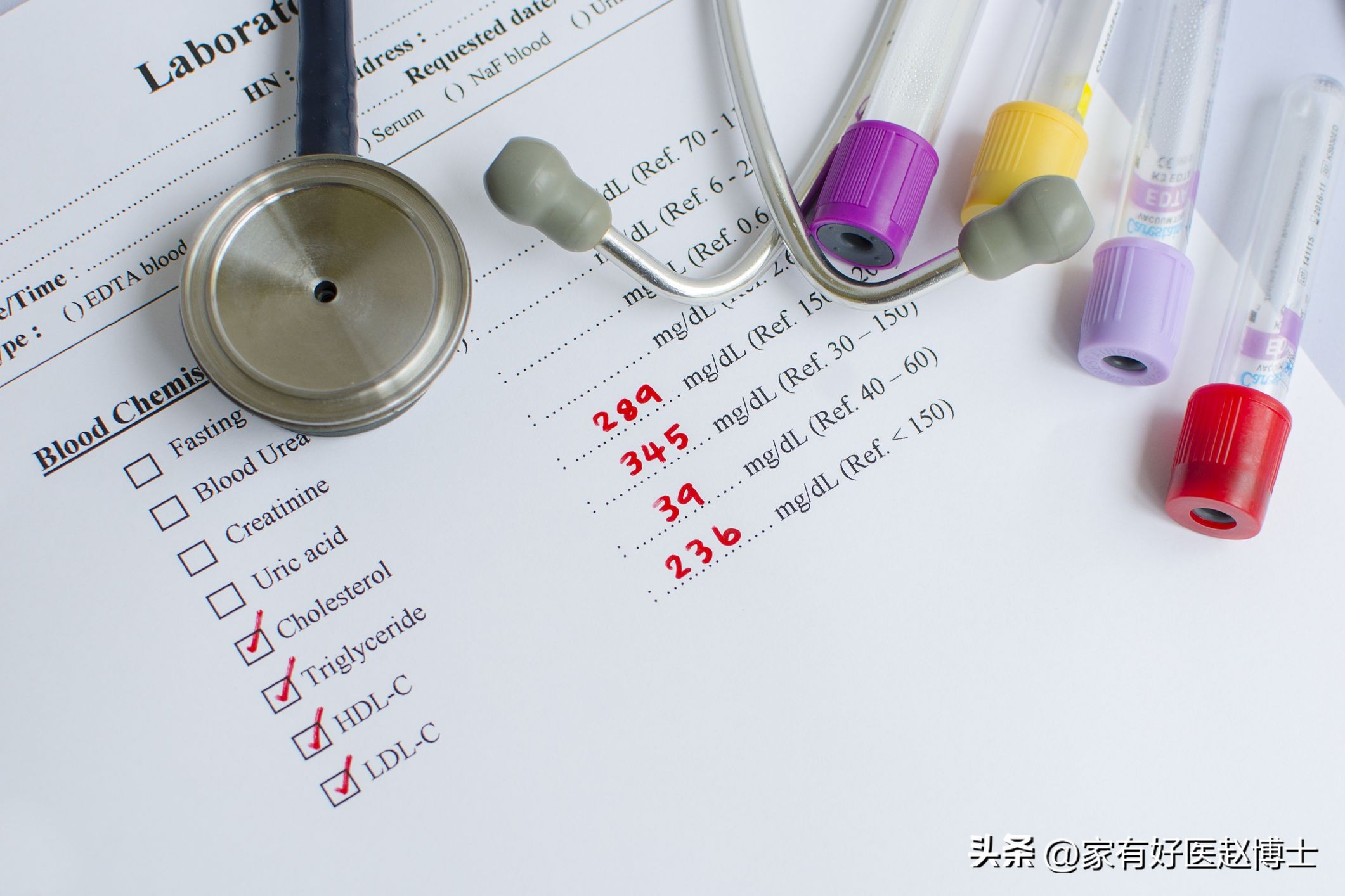 胆固醇多高需要吃他汀降脂药降脂,他汀类药降胆固醇又降脂吗