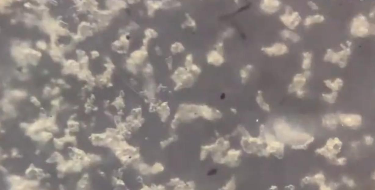 为什么抠肚脐眼肚子痛怎么缓解,抠肚脐眼肠子疼