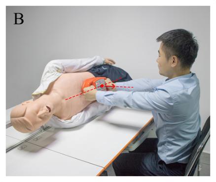 腹部提压心肺复苏术有用吗,腹部提压心肺复苏和胸外心脏按压