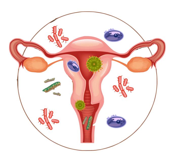 女性健康知识之——盆腔炎知多少？