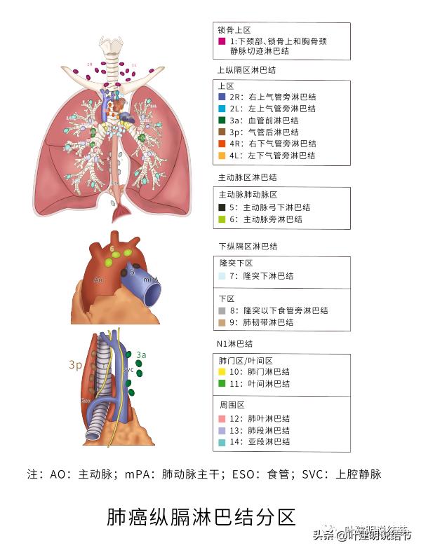有关肺部结节的知识,医生判定存在风险的肺结节
