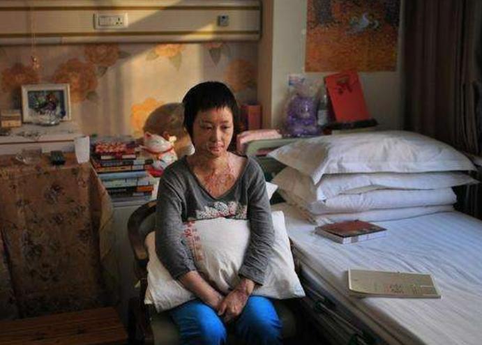 周岩毁容5年后的照片,周岩毁容事件图片