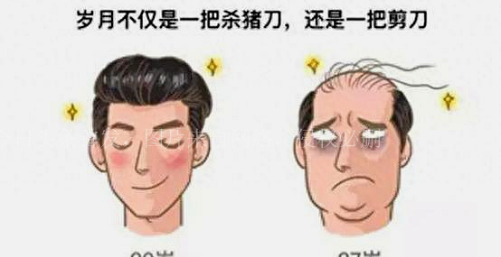 沙溢脱发搞笑,沙溢脱发