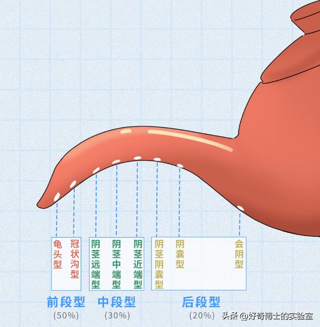 男生丁丁变歪是身体出了什么问题吗？影不影响*生活性**？