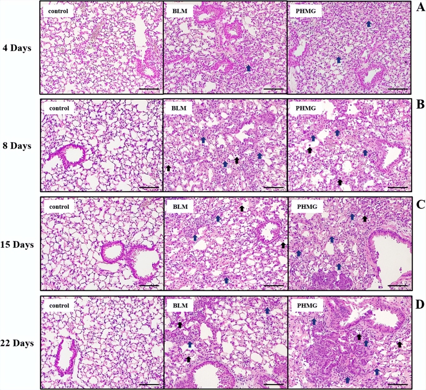 日本加湿器除菌死亡事件,韩国加湿器杀菌剂致死事件原因