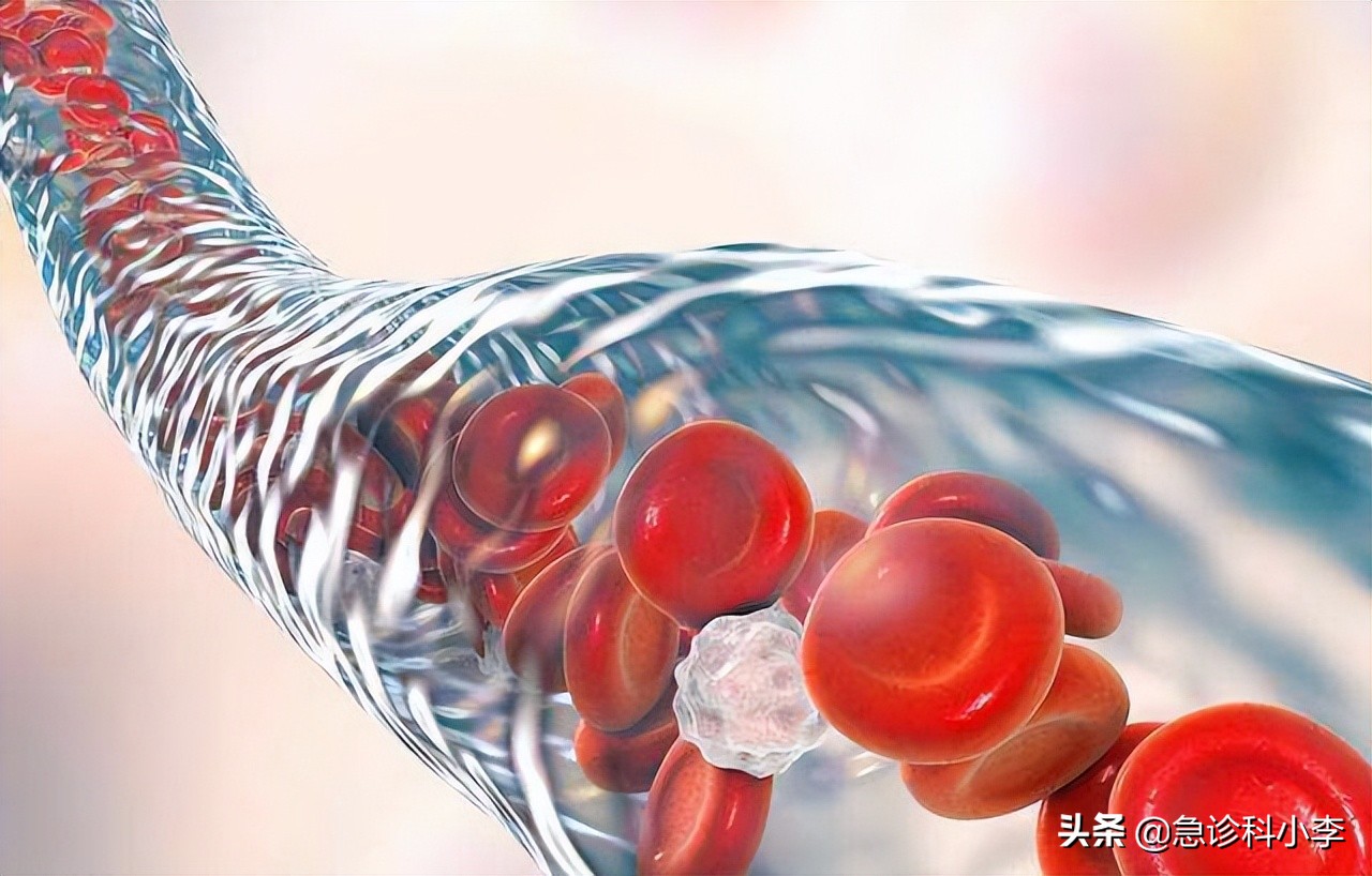 喝水对肾怎么样,喝水越多对身体越好这是真的吗