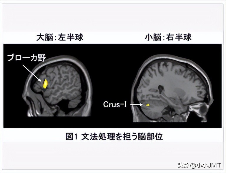 语言和大脑小脑还是脑干有关,大脑控制语言功能还是小脑
